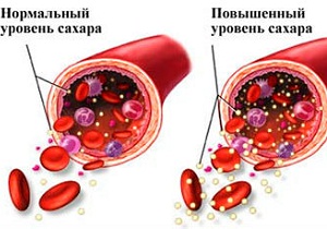 норма сахара в крови таблица по возрасту