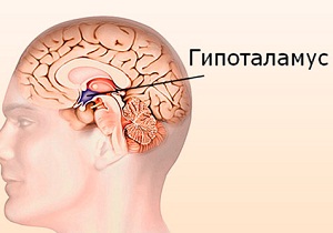 опухоли гипоталамуса и гипофиза симптомы у женщин