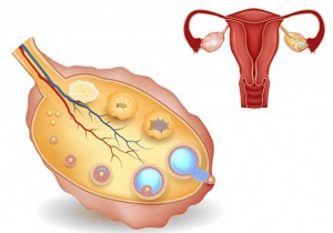 что такое фолликулы в яичниках у женщин