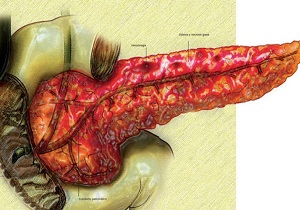 чем лечить панкреатит поджелудочной железы