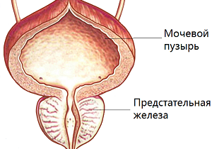 воспаление предстательной железы у мужчин симптомы лечение