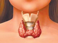 кальцинаты в щитовидной железе