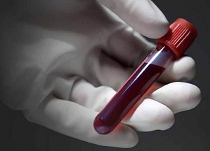 Аутоиммунные антитела к рецепторам ТТГ: что означают результаты анализа и каковы причины отклонений что означают результаты анализа антител к рецепторам ТТГ