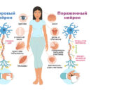 Рассеянный склероз — что за заболевание, и особенности его протекания