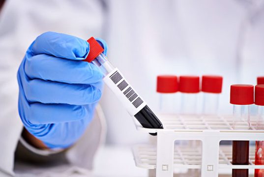 Медицинские анализы в Балашихе: какие показатели нельзя игнорировать после 40 лет