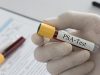 Уролог Артеменко рассказал о ранних симптомах рака простаты и главных мифах
