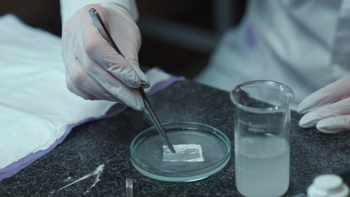 В НИТУ МИСИС разработали инновационную многофункциональную раневую повязку