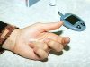 Болезнь Шегрена: когда сухость глаз и проблемы с кишечником говорят о заболевании