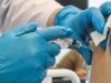 В России первые пациенты готовятся к получению вакцины от меланомы