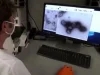 Оспа обезьян уже в России: кому и чем грозит новый вирус