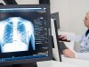 Минздрав: пациенты с ВИЧ и туберкулезом получают медпомощь в РФ бесплатно