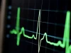 Science: сокращения сердца могут подавлять рост раковых клеток